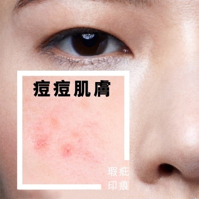 LA ROCHE POSAY 控油淨化去角質啫喱 200ML