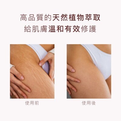 NEW ANGANCE Toning Body Lotion Stretch Marks Removal 150ml