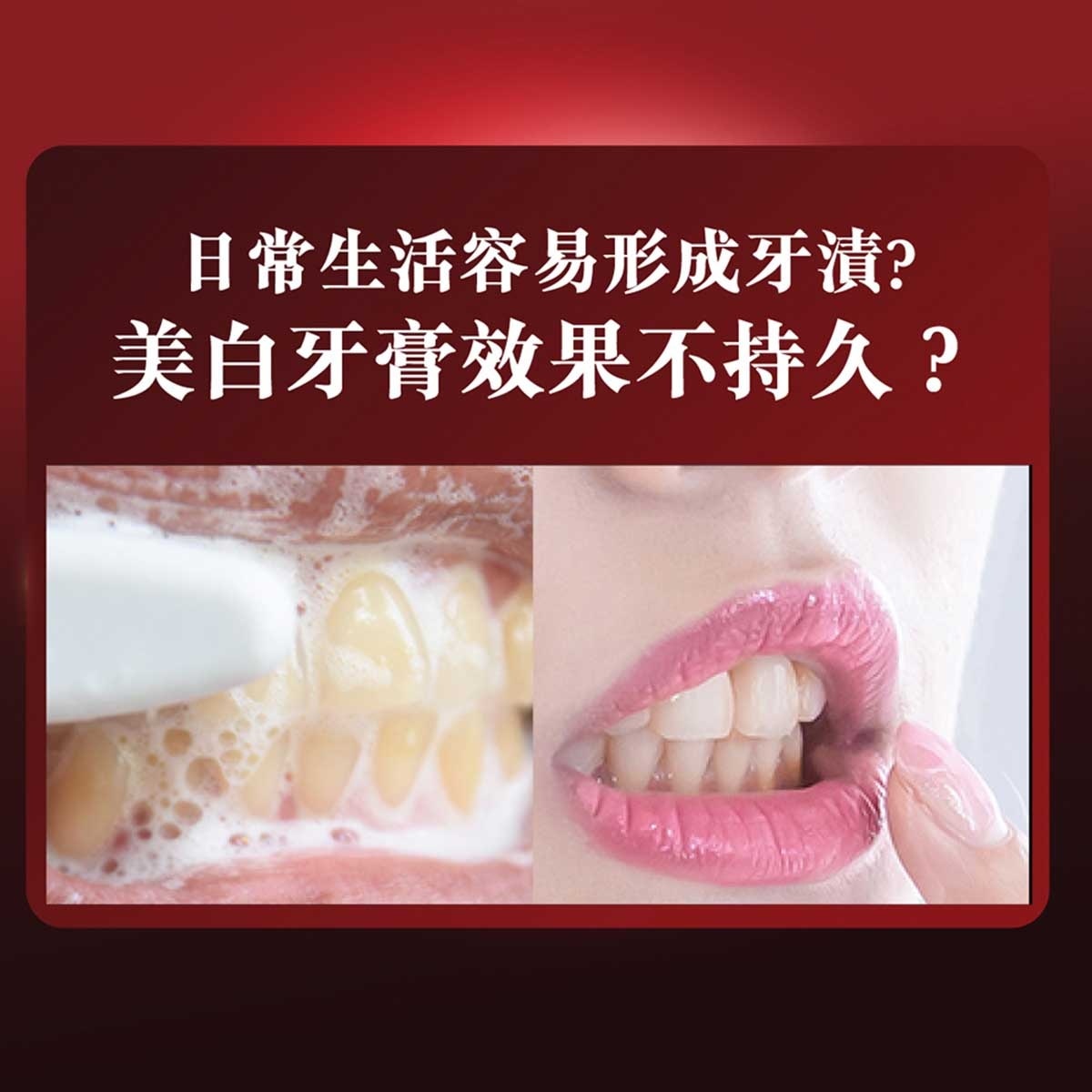 高露潔  12小時長效防漬174%+br/- 保護琺瑯質，適合每天使用br/- 居家享受專業級美白效果br/br/^^根據2025年香港國際牙科博覽暨研討會問卷調查，hydrogen Peroxide (hp)為最多受訪牙醫、牙科治療師及牙齒衛生員首選的美白成分。高露潔美白牙膏所含hp濃度與實際診所使用濃度不同。br/^高露潔美白牙膏中，含最高hydrogen Peroxide牙醫美白成分br/*兩星期每天使用兩次，效果因人而異br/+源自實驗室功效評估報告，對比高露潔普通含氟牙膏br/