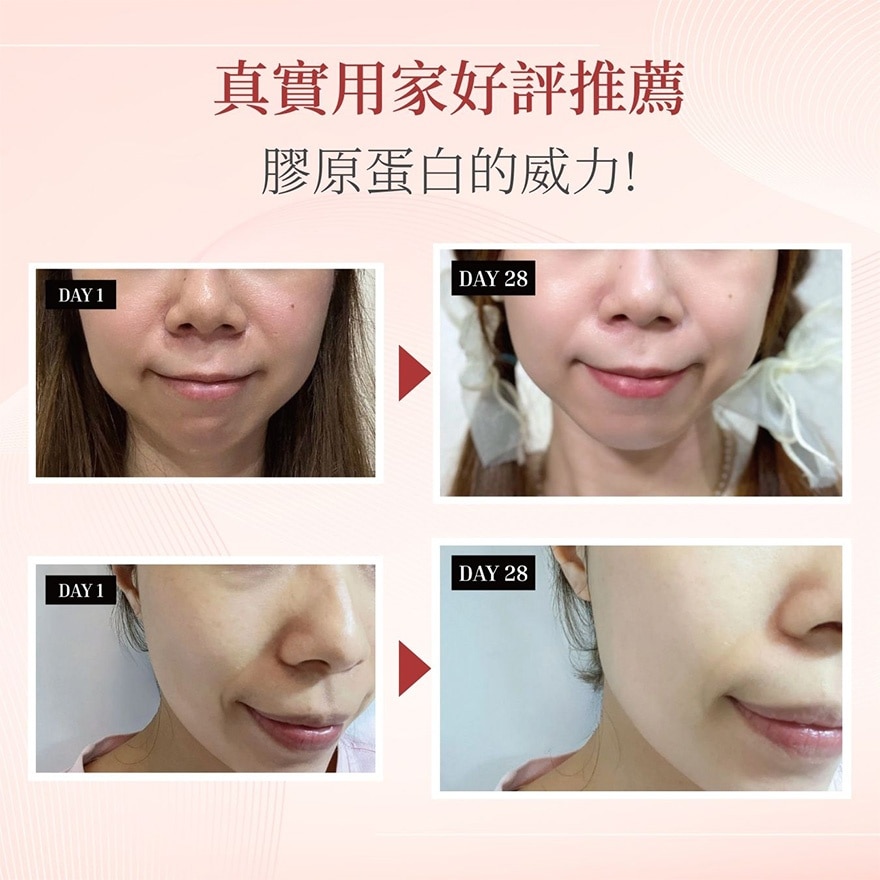 QOLLABS Skin Glow-up Probiotics Collagen Powder (power Boost) Individual Pack 30 Days