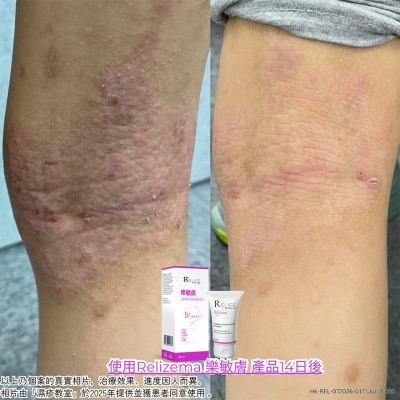 樂敏膚 樂敏膚抗氧治療潤膚膏40亳升 image