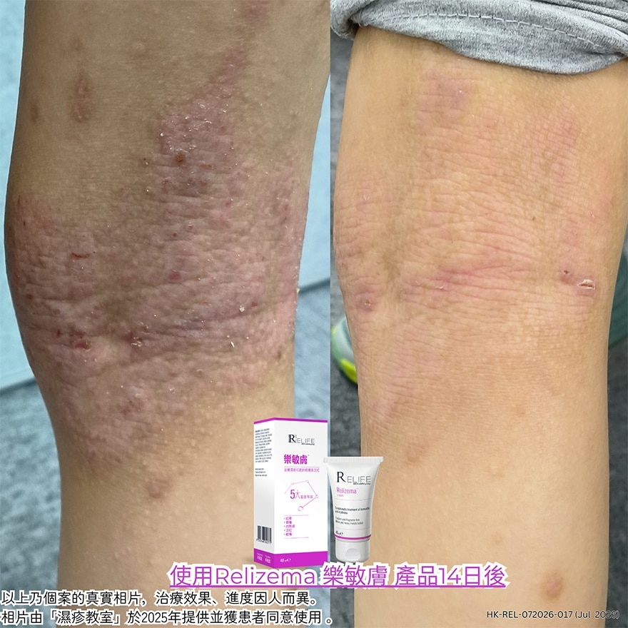 樂敏膚 樂敏膚抗氧治療潤膚膏40亳升 image