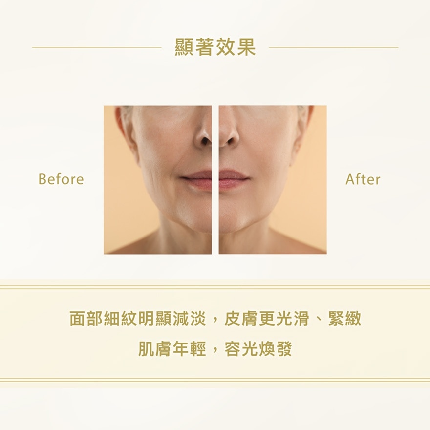 NEW ANGANCE 小金瓶肌因賦活精華