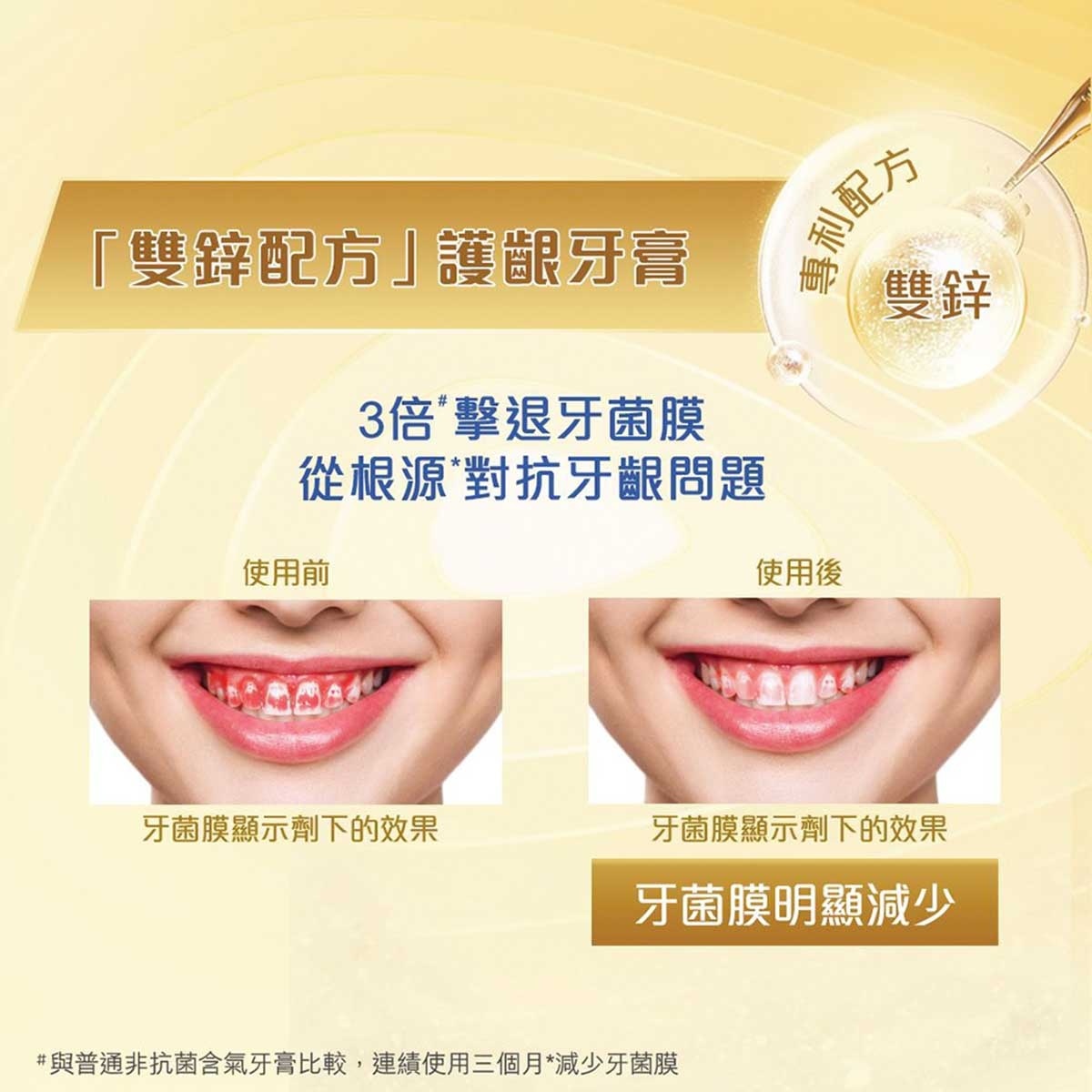 高露潔 高露潔牙菌斑深潔直立按壓式牙膏100毫升