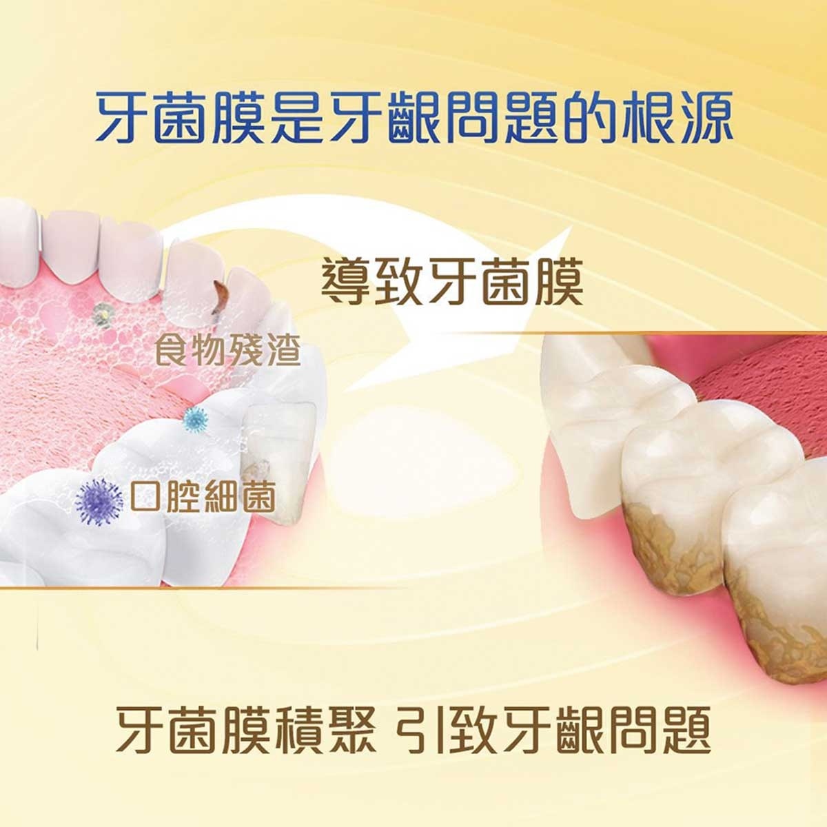 高露潔 高露潔牙菌斑深潔直立按壓式牙膏100毫升