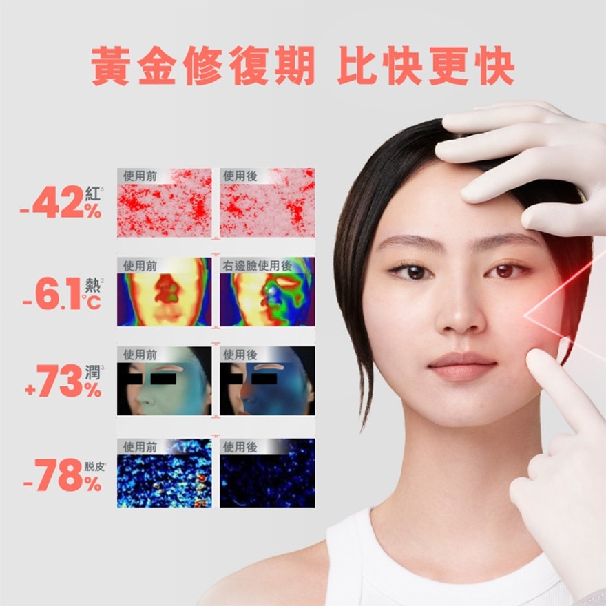 AVENE 密集修護面膜 5片 image